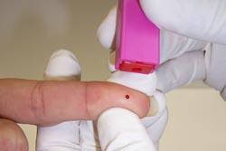 Testes rápidos de HIV disponíveis nos centros de saúde